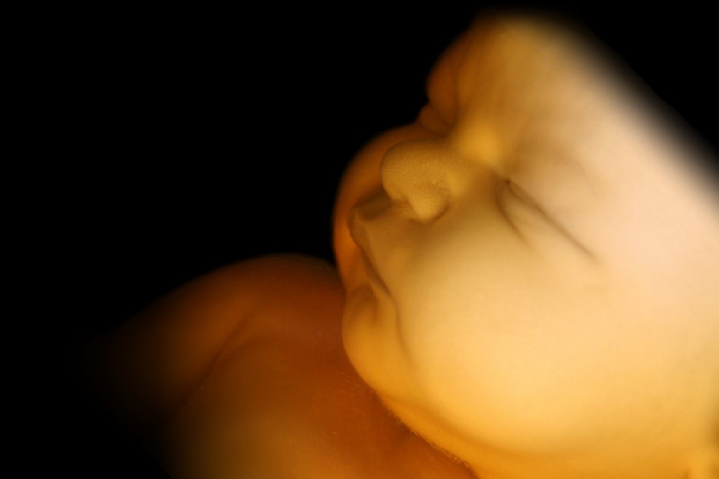 Prenatal Peek San Jose 3d 4d Ultrasound